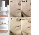 The Ordinary - Ácido Láctico 10%