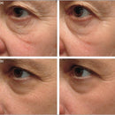 The Inkey List Jabon Facial Ácido Salicílico Antiacne Antigrasa