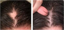 The Ordinary Suero Para Crecer Abunda El Pelo Y Evitar Caída