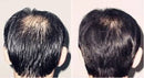 The Ordinary Suero Para Crecer Abunda El Pelo Y Evitar Caída