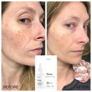 The Ordinary Alpha Arbutin 2% + HA