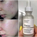 The Ordinary - Niacinamida 10% y Zinc 1%
