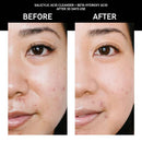 The Inkey List Bet Hydroxy Acid