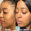 Good Molecules Tónico Glicólico