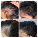 The Ordinary Suero Para Crecer Abunda El Pelo Y Evitar Caída