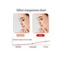 Corrector De Nariz Moldeador