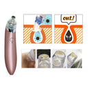 Extractor De Espinillas Y Acné