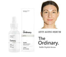 The Ordinary - "Buffet" Antiedad