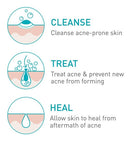 Cerave Limpiador Acné Benzoilo